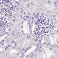 Invitrogen CDSN Polyclonal Antibody 100 &mu;L; Unconjugated:Antibodies,