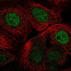 Invitrogen RCOR1 Polyclonal Antibody 100 &mu;L; Unconjugated:Antibodies,