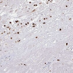 Invitrogen RCOR1 Polyclonal Antibody 100 &mu;L; Unconjugated:Antibodies,