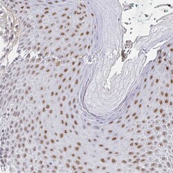 Invitrogen RCOR1 Polyclonal Antibody 100 &mu;L; Unconjugated:Antibodies,