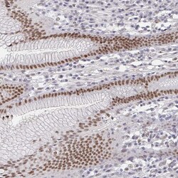 Invitrogen RCOR1 Polyclonal Antibody 100 &mu;L; Unconjugated:Antibodies,