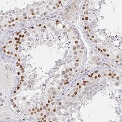 Invitrogen RCOR1 Polyclonal Antibody 100 &mu;L; Unconjugated:Antibodies,