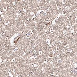 Invitrogen KLHL11 Polyclonal Antibody 100 &mu;L; Unconjugated:Antibodies,