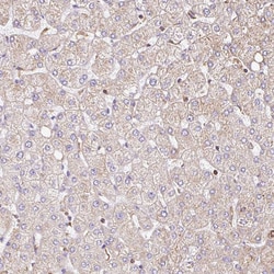 Invitrogen KLHL11 Polyclonal Antibody 100 &mu;L; Unconjugated:Antibodies,