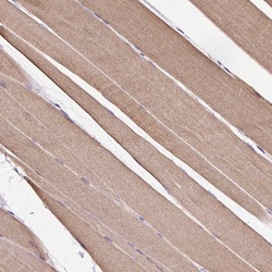 Invitrogen KLHL11 Polyclonal Antibody 100 &mu;L; Unconjugated:Antibodies,