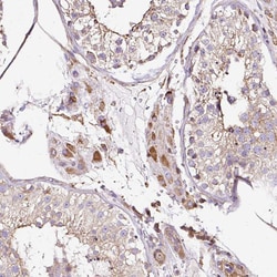 Invitrogen KLHL11 Polyclonal Antibody 100 &mu;L; Unconjugated:Antibodies,
