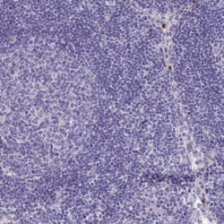 Invitrogen TAS2R38 Polyclonal Antibody 100 &mu;L; Unconjugated:Antibodies,