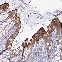 Invitrogen TAS2R38 Polyclonal Antibody 100 &mu;L; Unconjugated:Antibodies,