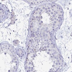 Invitrogen TAS2R38 Polyclonal Antibody 100 &mu;L; Unconjugated:Antibodies,