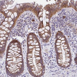 Invitrogen IL-37 Polyclonal Antibody 100 &mu;L; Unconjugated:Antibodies,
