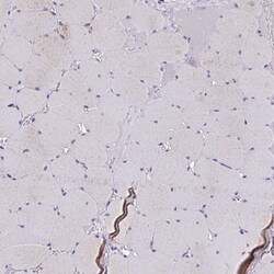 Invitrogen IL-37 Polyclonal Antibody 100 &mu;L; Unconjugated:Antibodies,