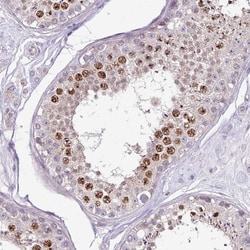 Invitrogen IMUP Polyclonal Antibody 100 &mu;L; Unconjugated:Antibodies,