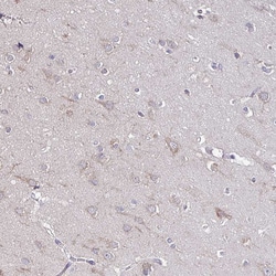 Invitrogen SKIV2L Polyclonal Antibody 100 &mu;L; Unconjugated:Antibodies,