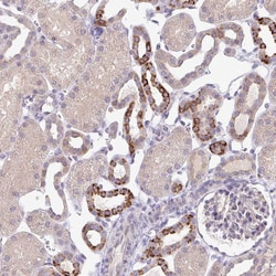 Invitrogen SKIV2L Polyclonal Antibody 100 &mu;L; Unconjugated:Antibodies,