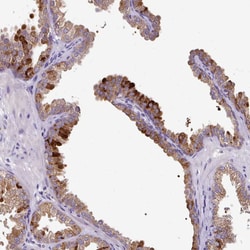 Invitrogen SKIV2L Polyclonal Antibody 100 &mu;L; Unconjugated:Antibodies,