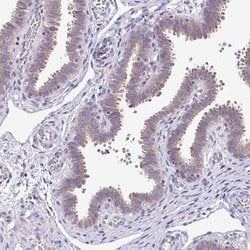 Invitrogen SKIV2L Polyclonal Antibody 100 &mu;L; Unconjugated:Antibodies,