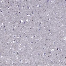 Invitrogen Spectrin beta-4 Polyclonal Antibody 100 &mu;L; Unconjugated:Antibodies,