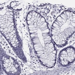 Invitrogen Spectrin beta-4 Polyclonal Antibody 100 &mu;L; Unconjugated:Antibodies,