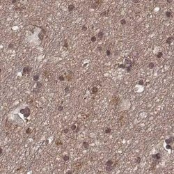 Invitrogen GSS Polyclonal Antibody 100 &mu;L; Unconjugated:Antibodies,