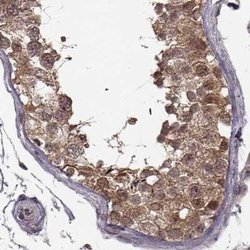 Invitrogen GSS Polyclonal Antibody 100 &mu;L; Unconjugated:Antibodies,