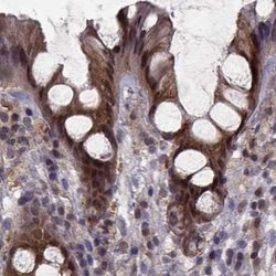Invitrogen GSS Polyclonal Antibody 100 &mu;L; Unconjugated:Antibodies,