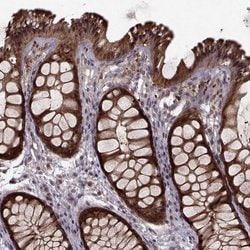 Invitrogen GSS Polyclonal Antibody 100 &mu;L; Unconjugated:Antibodies,
