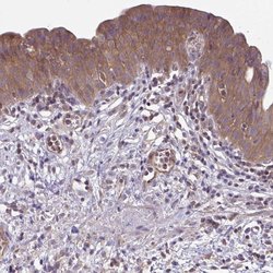 Invitrogen IST1 Polyclonal Antibody 100 &mu;L; Unconjugated:Antibodies,