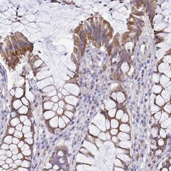 Invitrogen MRPS16 Polyclonal Antibody 100 &mu;L; Unconjugated:Antibodies,