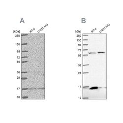 Invitrogen MRPS16 Polyclonal Antibody 100 &mu;L; Unconjugated:Antibodies,