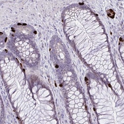 Invitrogen Krt222 Polyclonal Antibody 100 &mu;L; Unconjugated:Antibodies,