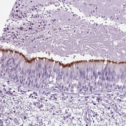 Invitrogen CCDC151 Polyclonal Antibody 100 &mu;L; Unconjugated:Antibodies,