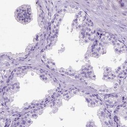 Invitrogen CCDC151 Polyclonal Antibody 100 &mu;L; Unconjugated:Antibodies,