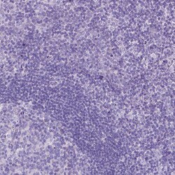 Invitrogen CCDC151 Polyclonal Antibody 100 &mu;L; Unconjugated:Antibodies,