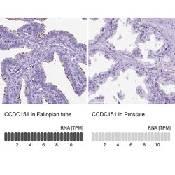 Invitrogen CCDC151 Polyclonal Antibody 100 &mu;L; Unconjugated:Antibodies,