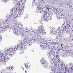 Invitrogen CCDC151 Polyclonal Antibody 100 &mu;L; Unconjugated:Antibodies,