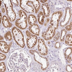 Invitrogen DAAM2 Polyclonal Antibody 100 &mu;L; Unconjugated:Antibodies,