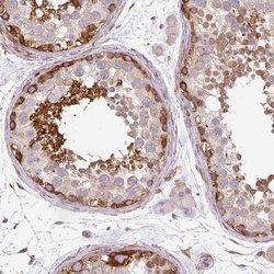 Invitrogen MAP1S Polyclonal Antibody 100 &mu;L; Unconjugated:Antibodies,