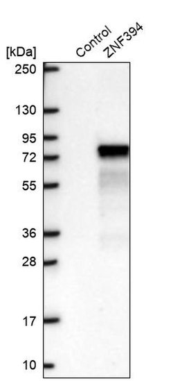 Invitrogen ZNF394 Polyclonal Antibody 100 μL; Unconjugated:Antibodies,