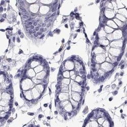 Invitrogen PLIN4 Polyclonal Antibody 100 &mu;L; Unconjugated:Antibodies,
