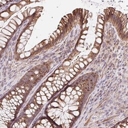 Invitrogen LYPD5 Polyclonal Antibody 100 &mu;L; Unconjugated:Antibodies,