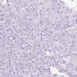Invitrogen SLC8A2 Polyclonal Antibody 100 &mu;L; Unconjugated:Antibodies,
