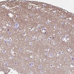 Invitrogen SLC8A2 Polyclonal Antibody 100 &mu;L; Unconjugated:Antibodies,