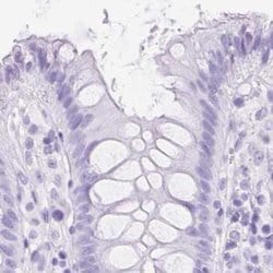 Invitrogen SLC8A2 Polyclonal Antibody 100 &mu;L; Unconjugated:Antibodies,