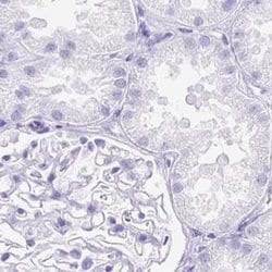 Invitrogen SLC8A2 Polyclonal Antibody 100 &mu;L; Unconjugated:Antibodies,