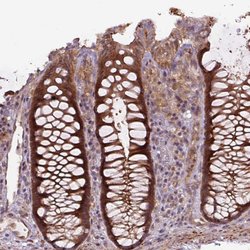 Invitrogen ZSWIM7 Polyclonal Antibody 100 &mu;L; Unconjugated:Antibodies,