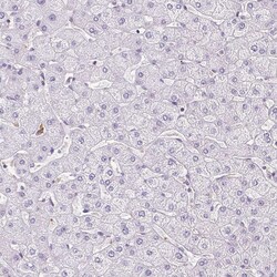 Invitrogen B3GALT5 Polyclonal Antibody 100 &mu;L; Unconjugated:Antibodies,