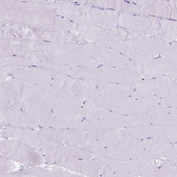 Invitrogen B3GALT5 Polyclonal Antibody 100 &mu;L; Unconjugated:Antibodies,
