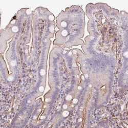 Invitrogen B3GALT5 Polyclonal Antibody 100 &mu;L; Unconjugated:Antibodies,