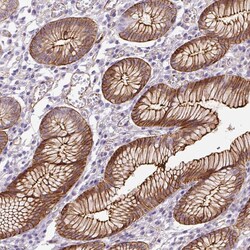 Invitrogen B3GALT5 Polyclonal Antibody 100 &mu;L; Unconjugated:Antibodies,