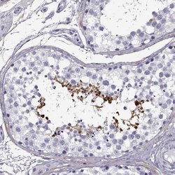 Invitrogen GTSF1L Polyclonal Antibody 100 &mu;L; Unconjugated:Antibodies,